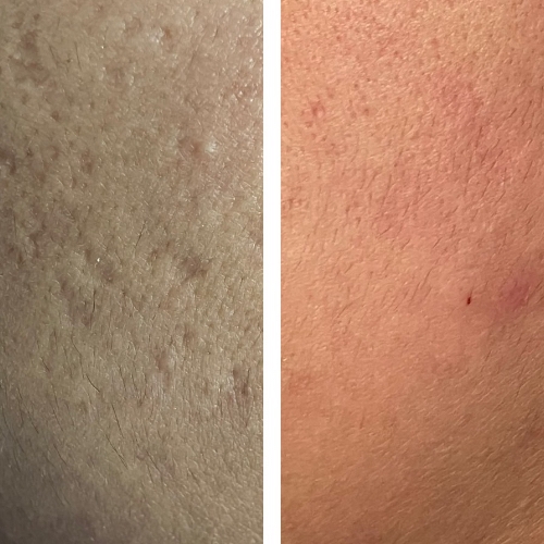 Elite Skin Clinic - Cobham
