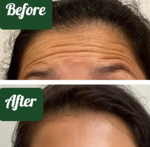 Elite Skin Clinic - Cobham & Harley Street